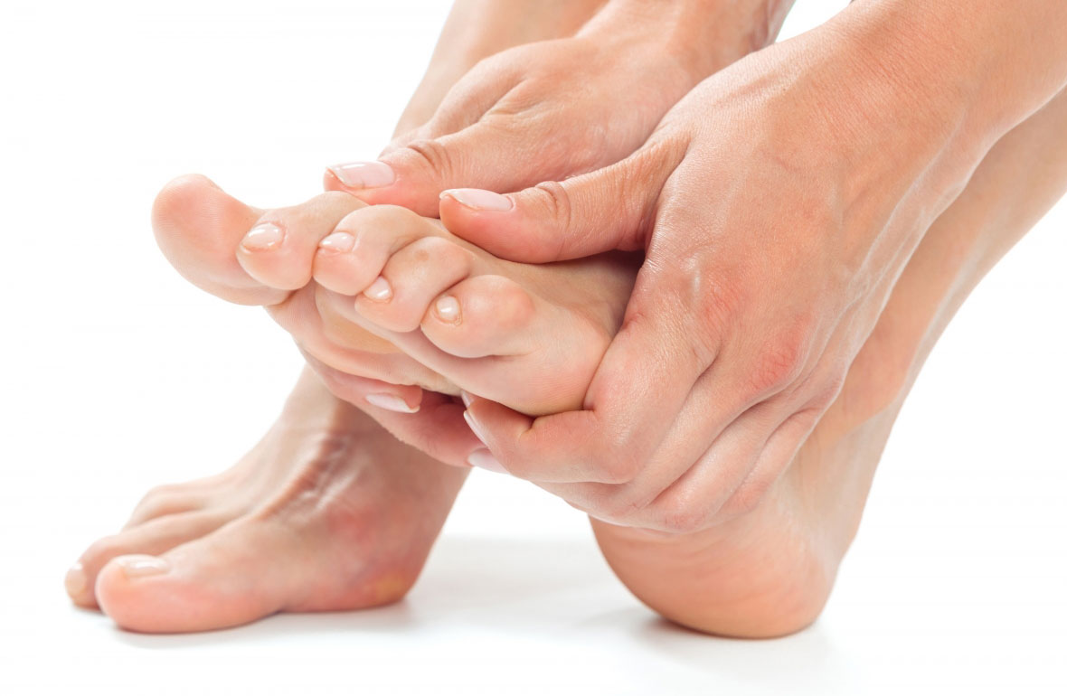 Peu amb deformitat rebregada que necessita ortesis de silicona per a la correcció i alleujament del dolor, tractament especialitzat a Podologia Balmes 74.